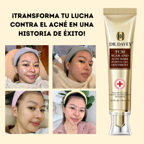 Dr.Davey® Crema Cicatrizante Anti Acné